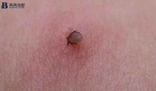 解讀蜱蟲預防與處理,值得收藏!
