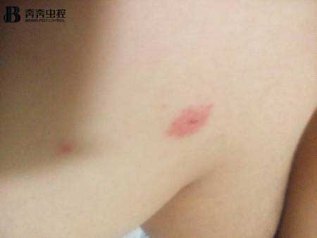 對抗蚊子塊的“終極武器”究竟是什么?